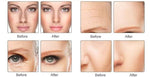 FlawlessGlow Diamond Microdermabrasion Beauty Wand