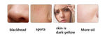 FlawlessGlow Diamond Microdermabrasion Beauty Wand